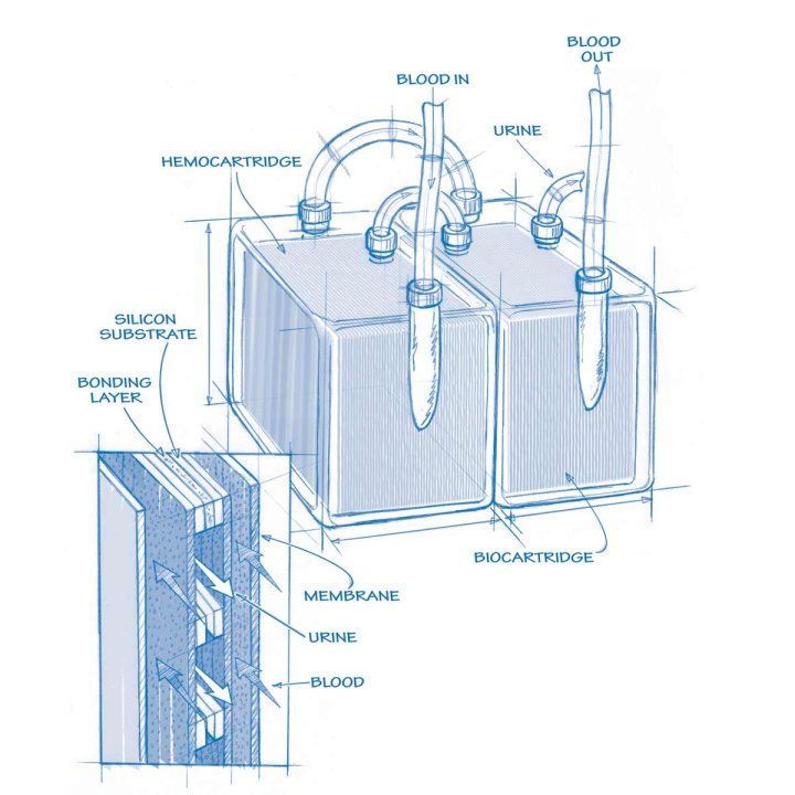 An early 2012 schematic of a device that would come to serve as an artificial kidney