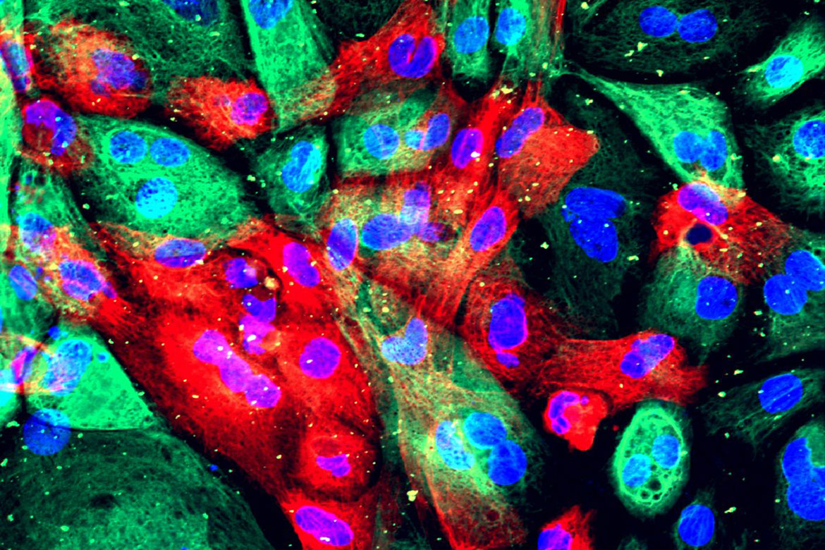 A colorful view of wild type human prostate cells from an organoid (a man-made construct that resembles an organ).