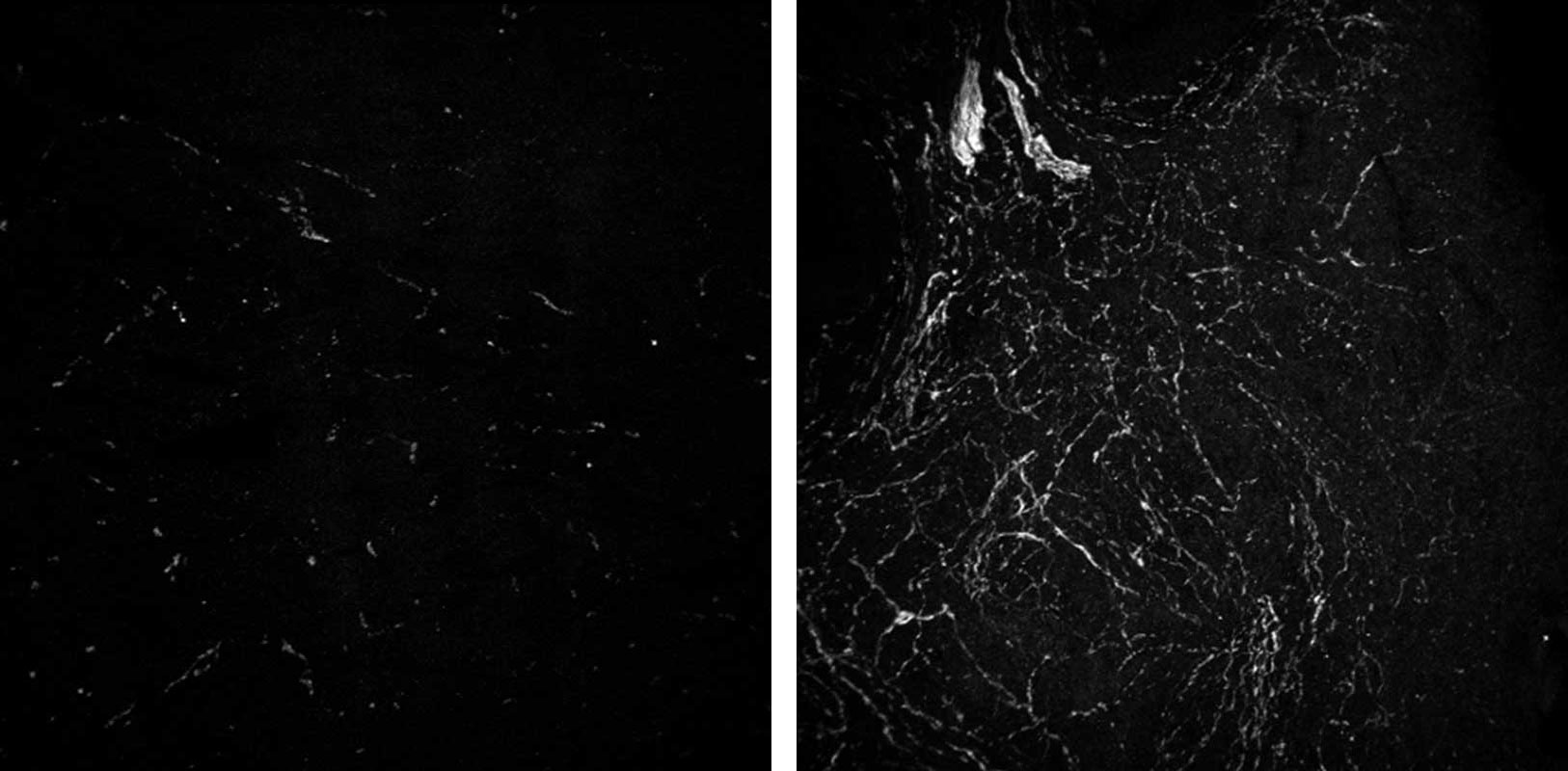 Black-and-white microscope images comparing nerve density in two human ovaries. The ovary on the left shows few thin, faint white lines against a dark background, indicating sparse nerve fibers, while the ovary on the right shows many bright, branching white lines, suggesting denser nerve growth and more extensive neural connections.