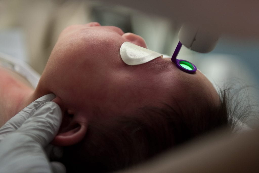 A baby with an eye patch is treated with laser surgery