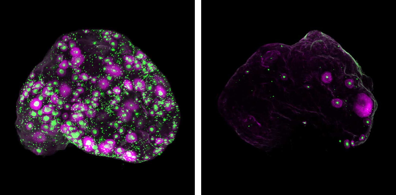 ChatGPT said:  Fluorescent microscope images comparing two mouse ovaries. The ovary on the left is densely speckled with bright green and magenta spots, indicating numerous developing follicles, while the ovary on the right shows far fewer green and magenta spots, suggesting reduced follicle activity. Both are shown against a black background.