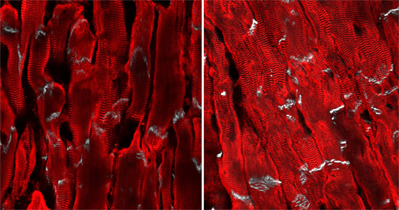 Image of mouse heart muscle