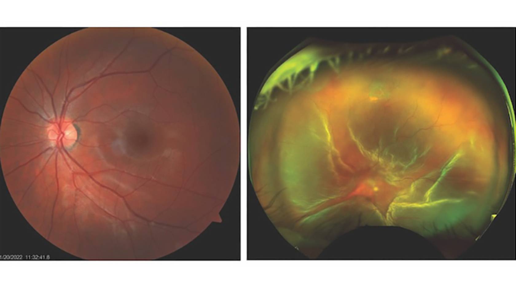 Two orb-shaped objects laced with fine lines and lighter spots against a black background