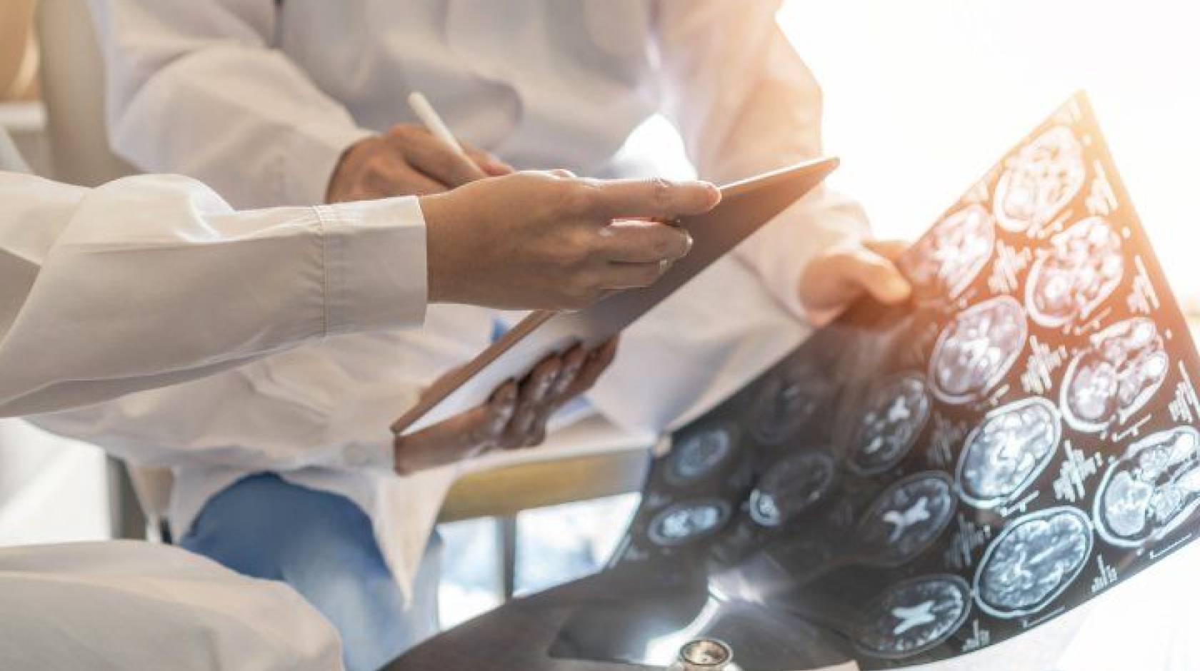 Doctors holding brain scans