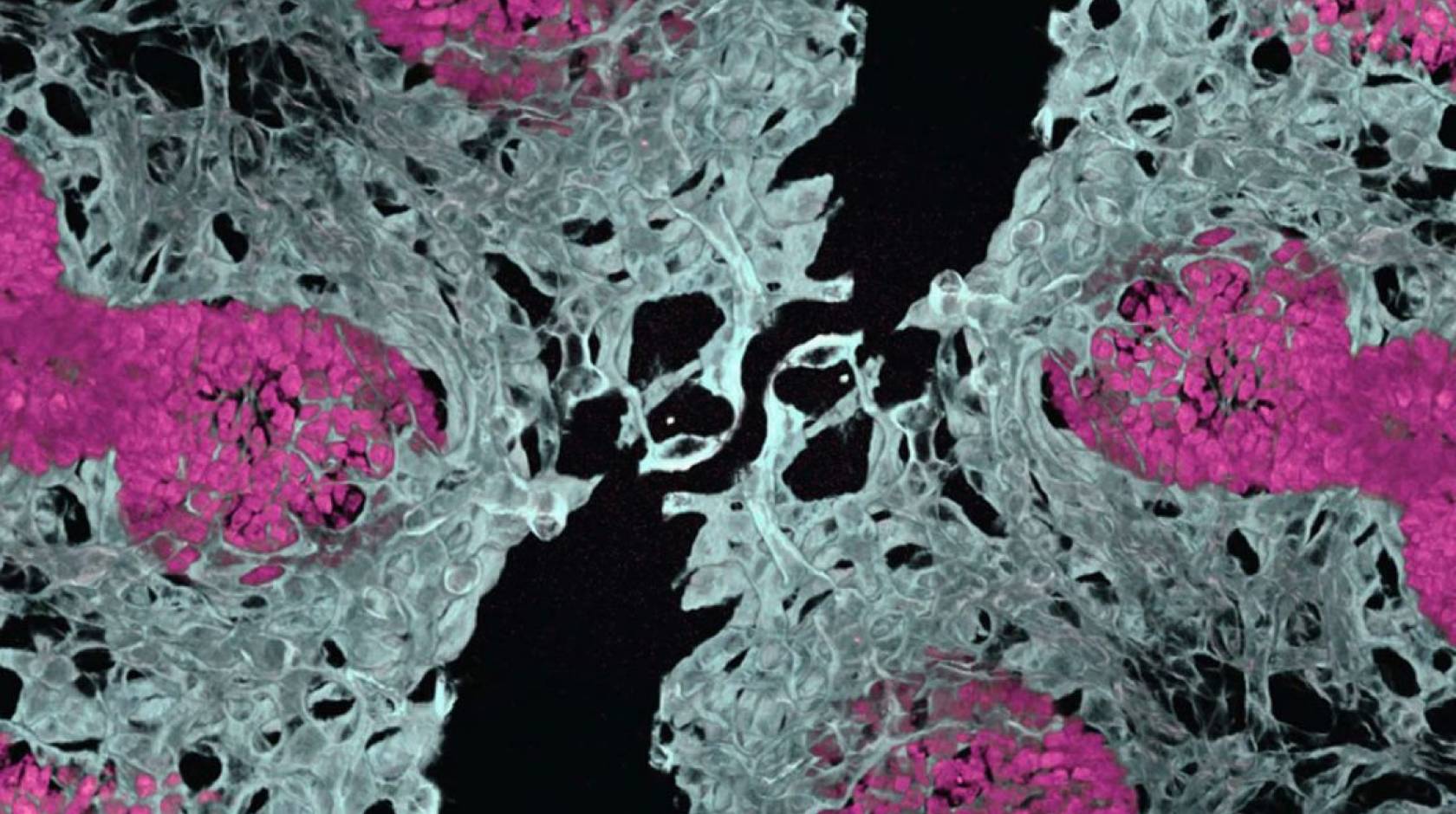 A microscope slide showing delicate gray structures interspersed with pink nodules, against a dark ground