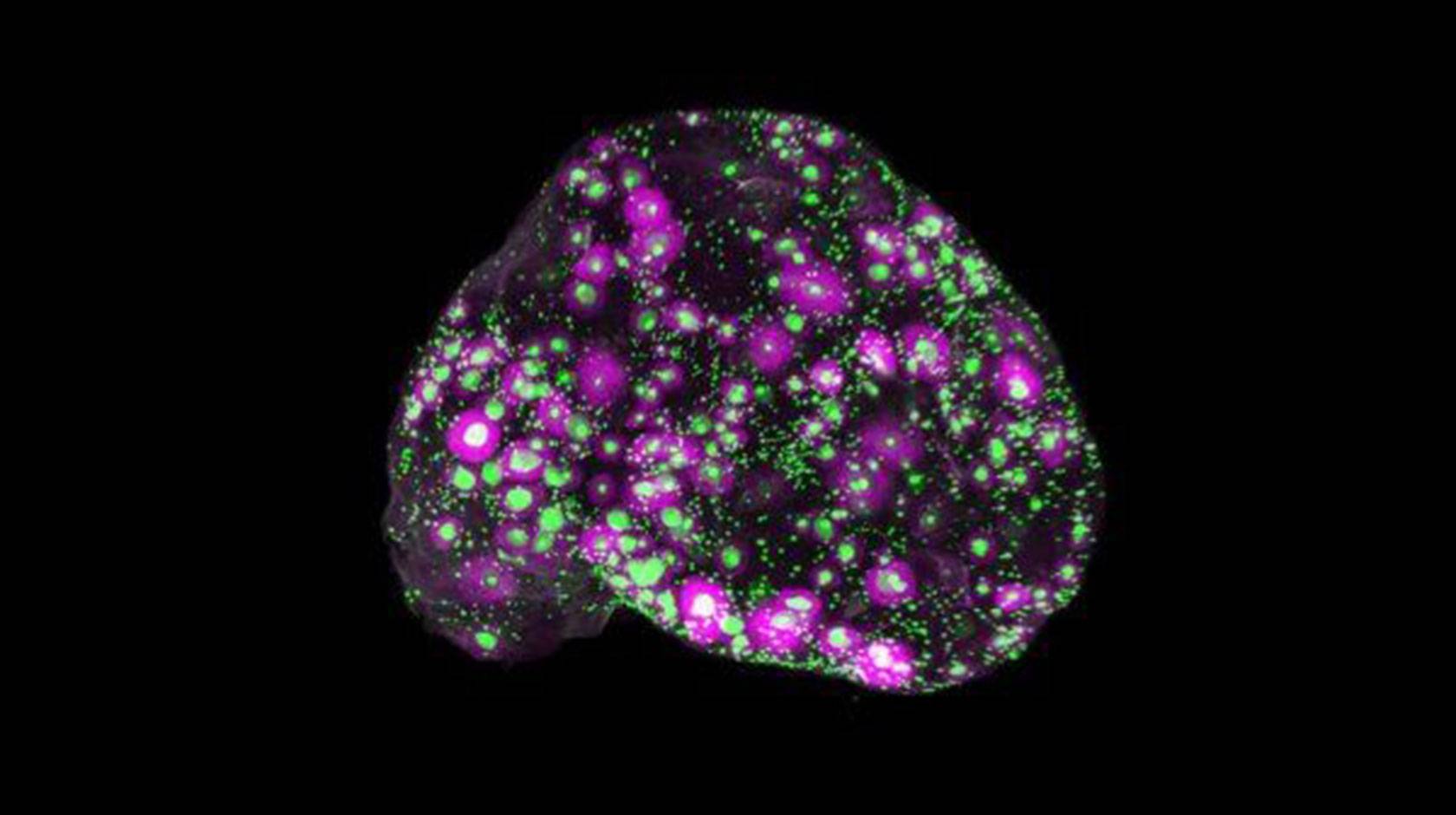 A 3D view of a whole mouse ovary, with every egg marked in green and the growing egg follicles in magenta.