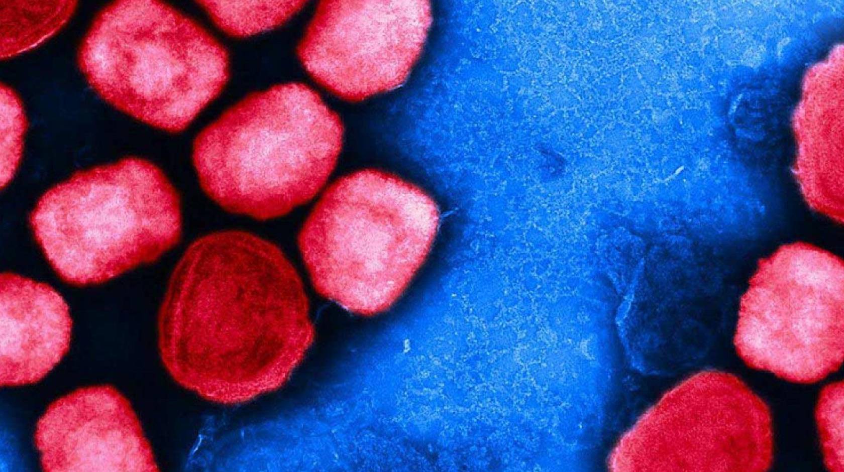 electron micrograph of mpox particles