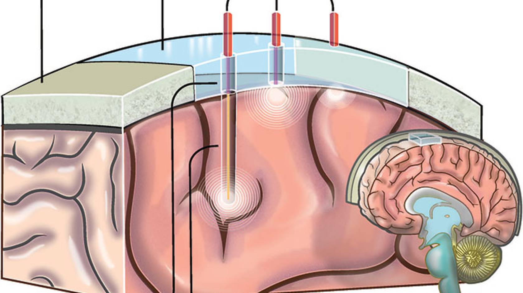 'window to the brain' graphic
