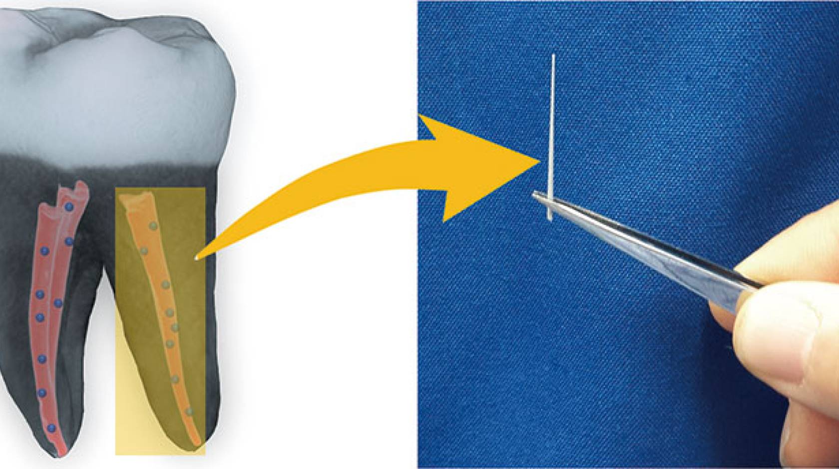 diagram, tooth and gutta percha