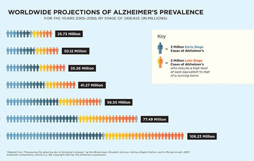 UCLA Alzheimer's Research