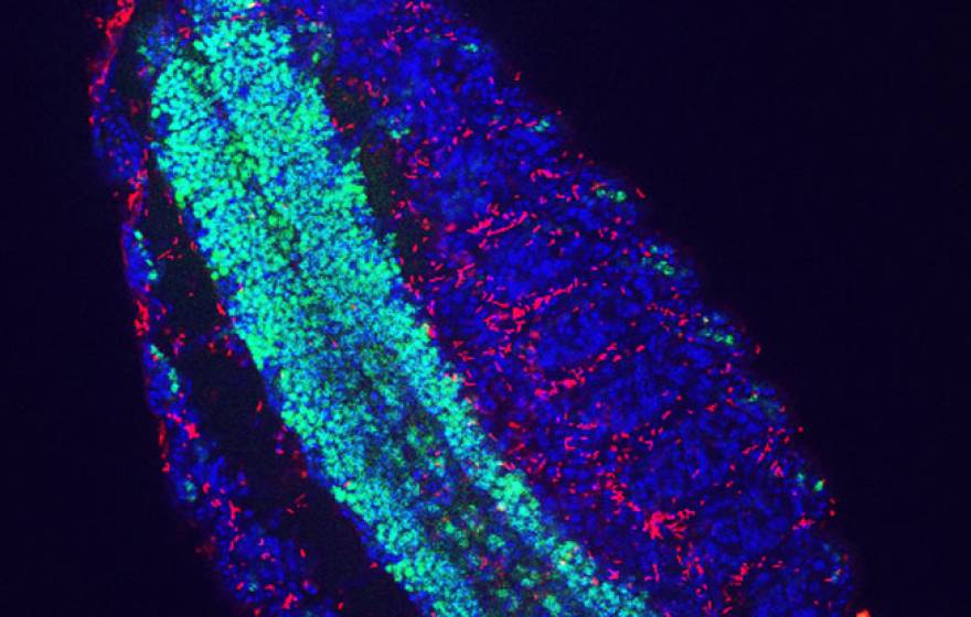 UC Riverside bacteria