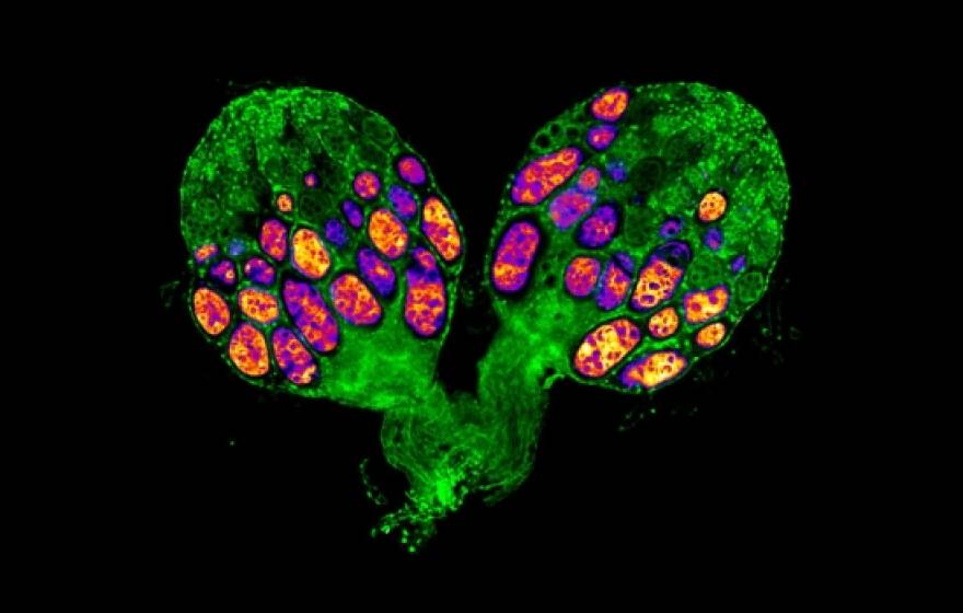 Image of an ovary from a diapausing fruit fly showing arrested egg development.