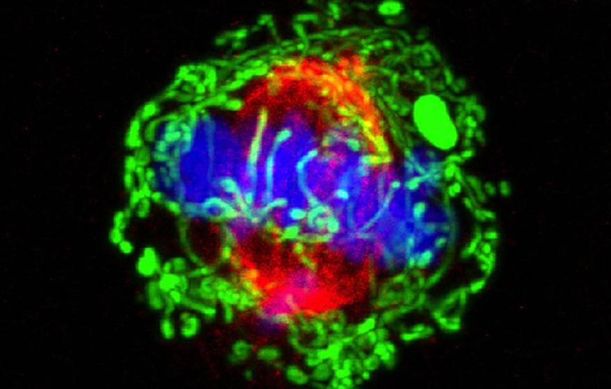 Dividing breast cancer cell