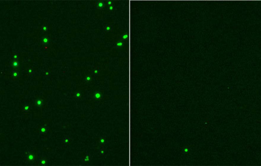 SARS-CoV-2 infection (green, left) is inhibited by 25HC treatment (right)