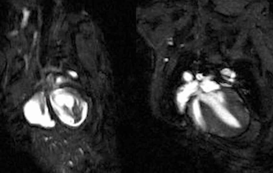 MRI photo of mouse's beating heart