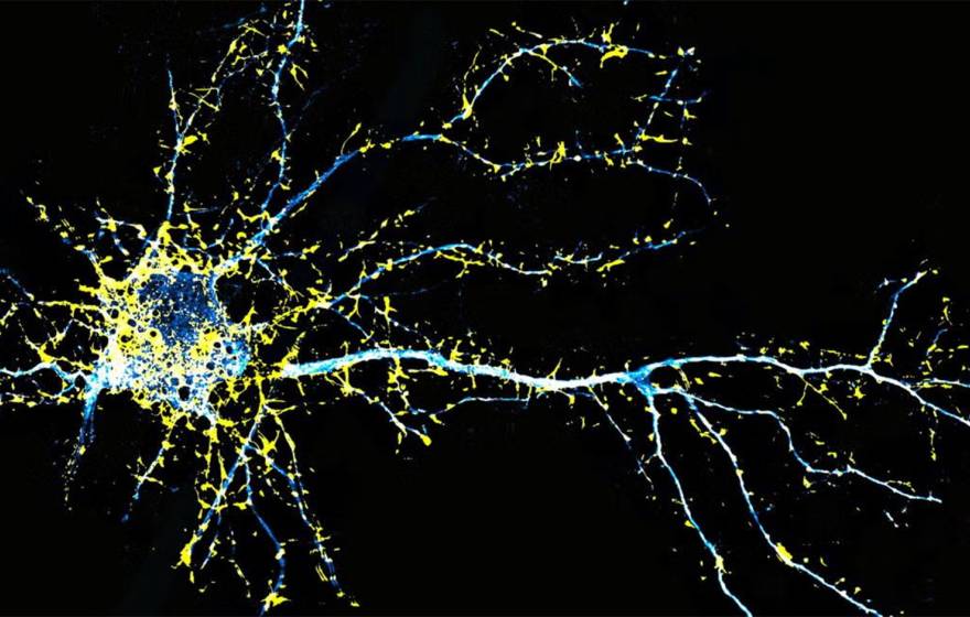 Illustration of a neuron colored in yellow and blue against a black background