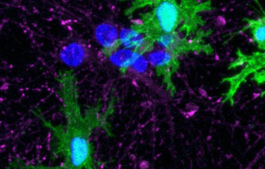 Close up image of microglia (green)
