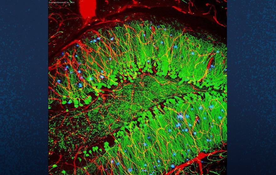 A scan of a mouse brain shows blood vessels (red), brain cells (green), and amyloid plaques (blue). A new gene therapy treatment developed by UC San Diego works by reprogramming the behavior of diseased brain cells. 