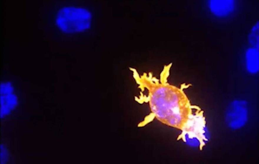 An orange-glowing oval patch and several small blue areas on a black background