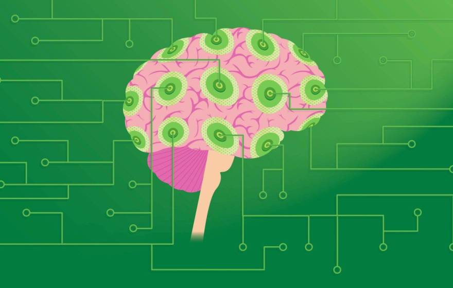 Illustration of a human brain in pink with green circular patterns overlaid, connected to a network of thin green circuit-like lines on a dark green background, suggesting a fusion of biology and technology.