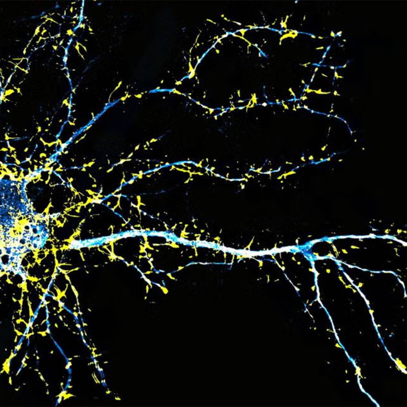 Illustration of a neuron colored in yellow and blue against a black background