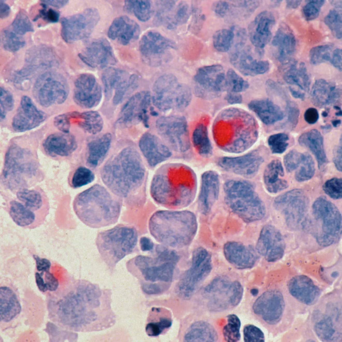 A microscopic view of purple and red cells