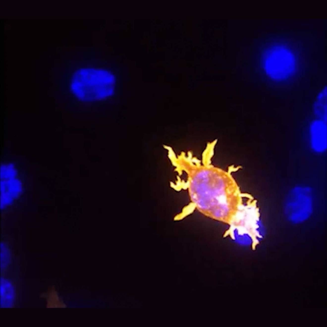 An orange-glowing oval patch and several small blue areas on a black background