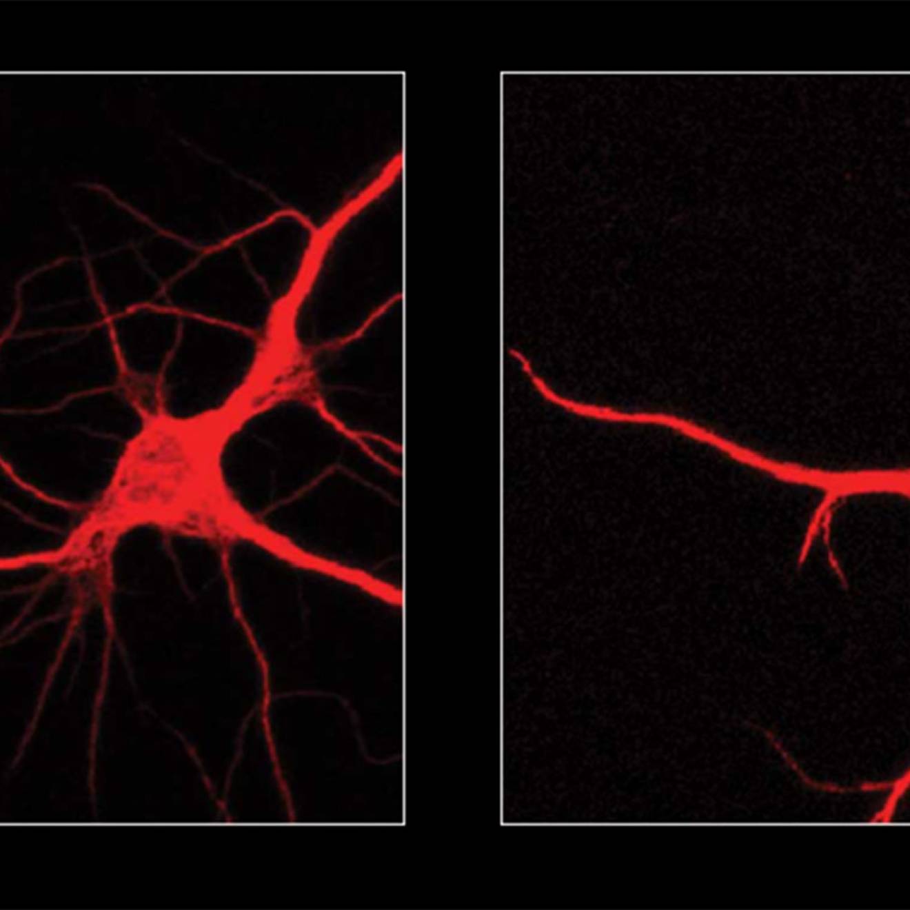 A microscope view of 2 neurons, stained red against a black backdrop. One has more branches than the other.